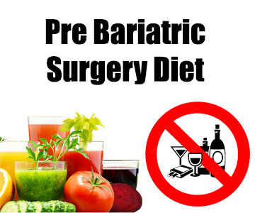 Pre Bariatric Surgery Diet